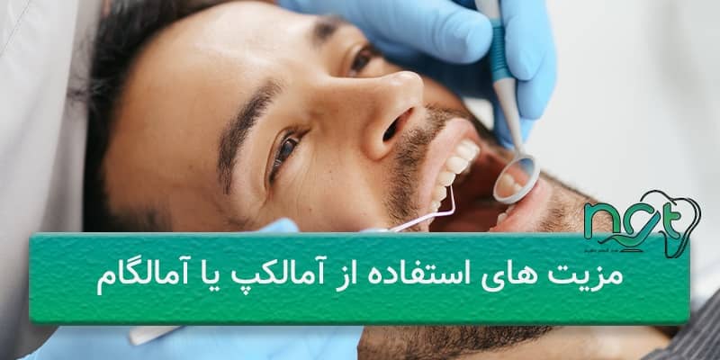 مزیت آمالکپ دندانپزشکی